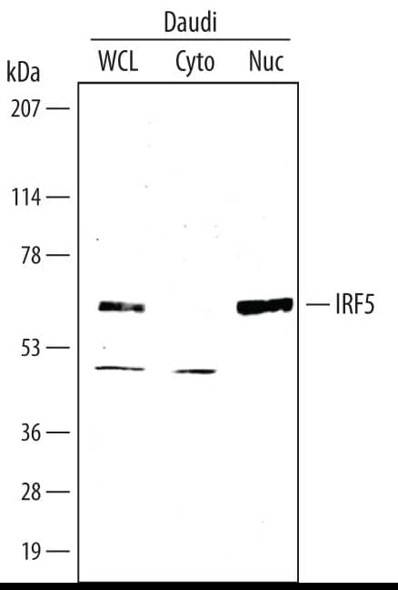 Western blot shows lysates of Daudi human Burkitt's lymphoma cell line. Gels were loaded with 30 µg of whole cell lysate (WCL), 20 µg of cytoplasmic (Cyto), and 10 µg of nuclear extracts (Nuc). PVDF membrane was probed with 2 µg/mL Sheep Anti-Human IRF5 Antigen Affinity-purified Polyclonal Antibody (Catalog # AF4508) followed by HRP-conjugated Anti-Mouse IgG Secondary Antibody (Catalog # HAF007). A specific band for IRF5 was detected at approximately 58 kDa (as indicated). This experiment was conducted under reducing conditions and using Immunoblot Buffer Group 3.
