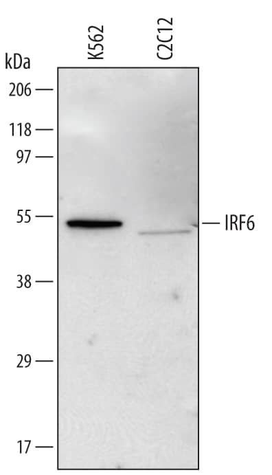 Western blot shows lysates of K562 human chronic myelogenous leukemia cell line and C2C12 mouse myoblast cell line. PVDF Membrane was probed with 1 µg/mL of Mouse Anti-Human/Mouse IRF6 Monoclonal Antibody (Catalog # MAB6114) followed by HRP-conjugated Anti-Mouse IgG Secondary Antibody (Catalog # HAF007). A specific band was detected for IRF6 at approximately 53 kDa (as indicated). This experiment was conducted under reducing conditions and using Immunoblot Buffer Group 1.