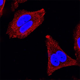 IRS1 was detected in immersion fixed MCF-7 human breast cancer cell line using Mouse Anti-Human IRS1 Monoclonal Antibody (Catalog # MAB39781) at 25 µg/mL for 3 hours at room temperature. Cells were stained using the NorthernLights™ 557-conjugated Anti-Mouse IgG Secondary Antibody (red; Catalog # NL007) and counterstained with DAPI (blue). Specific staining was localized to cytoplasm. View our protocol for Fluorescent ICC Staining of Cells on Coverslips.