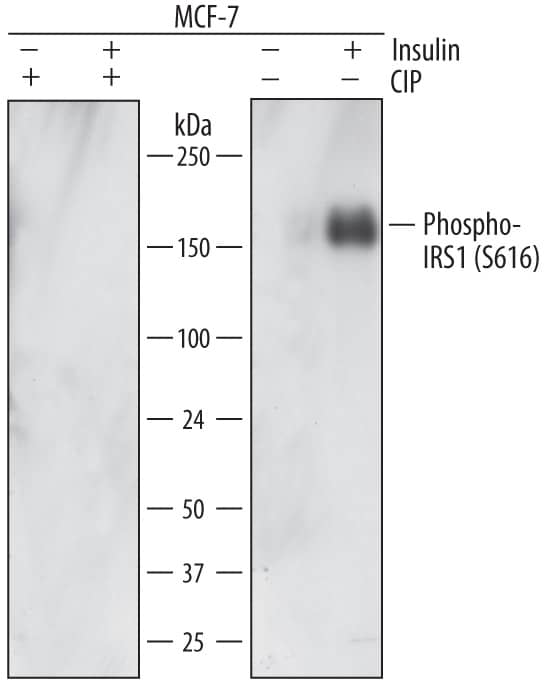 Western blot shows lysates of MCF-7 human breast cancer cell line untreated (-) or treated (+) with 1 µg/mL Insulin for 5 minutes and 300 U/mL CIP for 1 hour. PVDF membrane was probed with 1 µg/mL of Mouse Anti-Human Phospho-IRS1 (S616) Monoclonal Antibody (Catalog # MAB39783) followed by HRP-conjugated Anti-Mouse IgG Secondary Antibody (Catalog # HAF007). A specific band was detected for Phospho-IRS1 (S616) at approximately 150 kDa (as indicated). This experiment was conducted under reducing conditions and using Immunoblot Buffer Group 1.