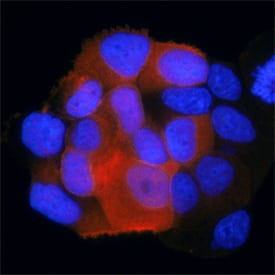 <b>Biological Strategies Validation. </b>IRS1 phosphorylated at Y1179 was detected in immersion fixed MCF-7 human breast cancer cell line using Mouse Anti-Human Phospho-IRS1 (Y1179) Monoclonal Antibody (Catalog # MAB7455) at 25 µg/mL for 3 hours at room temperature. Cells were stained using the NorthernLights™ 557-conjugated Anti-Mouse IgG Secondary Antibody (red; Catalog # NL007) and counterstained with DAPI (blue). Specific staining was localized to cytoplasm. View our protocol for Fluorescent ICC Staining of Cells on Coverslips.