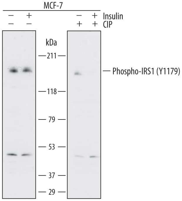 Western blot shows lysates of MCF-7 human breast cancer cell line untreated (-) or treated (+) with 1 µg/mL Insulin for 5 minutes and 300 U/mL CIP for 1 hour. PVDF membrane was probed with 1 µg/mL of Mouse Anti-Human Phospho-IRS1 (Y1179) Monoclonal Antibody (Catalog # MAB7455) followed by HRP-conjugated Anti-Mouse IgG Secondary Antibody (Catalog # HAF018). A specific band was detected for Phospho-IRS1 (Y1179) at approximately 150 kDa (as indicated). This experiment was conducted under reducing conditions and using Immunoblot Buffer Group 1.
