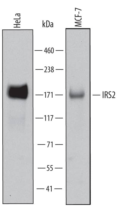 Western blot shows lysates of HeLa human cervical epithelial carcinoma cell line and MCF-7 human breast cancer cell line. PVDF Membrane was probed with 2 µg/mL of Sheep Anti-Human IRS2 Antigen Affinity-purified Polyclonal Antibody (Catalog # AF6347) followed by HRP-conjugated Anti-Sheep IgG Secondary Antibody (Catalog # HAF016). A specific band was detected for IRS2 at approximately 170-190 kDa (as indicated). This experiment was conducted under reducing conditions and using Immunoblot Buffer Group 2.
