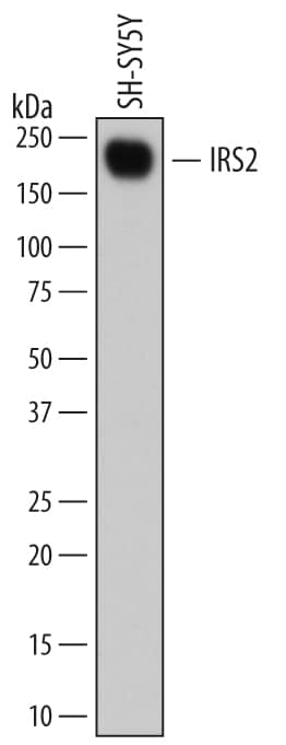 Western Blot IRS2 Antibody (676415) [Unconjugated]