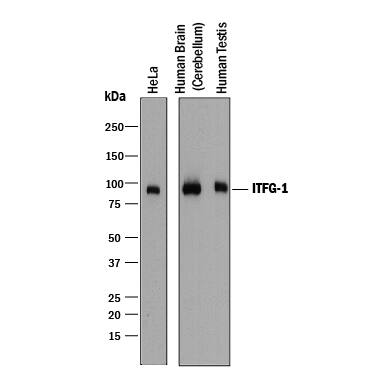 Western blot shows lysates of HeLa human cervical epithelial carcinoma cell line, human brain (cerebellum) tissue, and human testis tissue. PVDF membrane was probed with 2 µg/mL of Mouse Anti-Human ITFG1 Monoclonal Antibody (Catalog # MAB8900) followed by HRP-conjugated Anti-Mouse IgG Secondary Antibody (Catalog # HAF018). A specific band was detected for ITFG1 at approximately 95-100 kDa (as indicated). This experiment was conducted under reducing conditions and using Immunoblot Buffer Group 1.