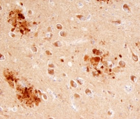 ITM2B was detected in immersion fixed paraffin-embedded sections of human Alzheimer's brain using Sheep Anti-Human ITM2B Antigen Affinity-purified Polyclonal Antibody (Catalog # AF7015) at 5 µg/mL overnight at 4 °C. Tissue was stained using the Anti-Sheep HRP-DAB Cell & Tissue Staining Kit (brown; Catalog # CTS019) and counterstained with hematoxylin (blue). Specific staining was localized to neurons and plaques. View our protocol for Chromogenic IHC Staining of Paraffin-embedded Tissue Sections.
