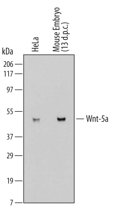 Western blot shows detection of Rat Anti-Human/Mouse Wnt-5a Monoclonal Antibody (MAB645) using a 1:1000 dilution of HRP-conjugated Anti-Rat IgG Secondary Antibody (Catalog # HAF005). This experiment was conducted under reducing conditions and using Immunoblot Buffer Group 1.
