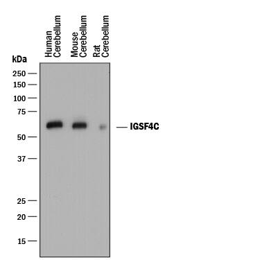 Western blot shows detection of Mouse Anti-Human/Mouse/Rat IGSF4C/SynCAM4 Monoclonal Antibody (Catalog # MAB41642) using a 1:1000 dilution of HRP-conjugated Anti-Mouse IgG Secondary Antibody (Catalog # HAF018). This experiment was conducted under reducing conditions and using Immunoblot Buffer Group 1.