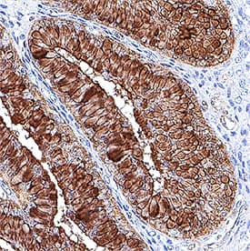 HSP27 was detected in paraffin-embedded sections human ovary using Rat Anti-Human HSP27 Monoclonal Antibody (Catalog # MAB15801) with Anti-Rat IgG VisUCyte HRP Polymer Antibody (Catalog # VC005). Tissue was stained with DAB (brown color) and counterstained with hematoxylin (blue color). View our protocol for theVisUCyte HRP Polymer Detection Reagent.