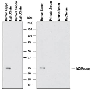 Western Blot Human Kappa Light Chain Antibody (999947) [Unconjugated]