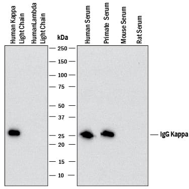 Western Blot Human Kappa Light Chain Antibody (999916) [Unconjugated]