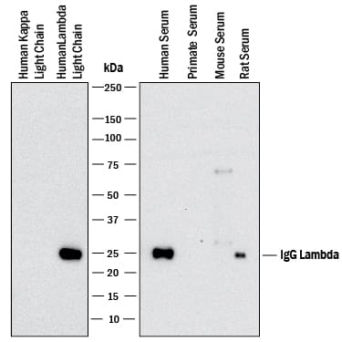 Western Blot Human lambda light chain Antibody (1000011) [Unconjugated]