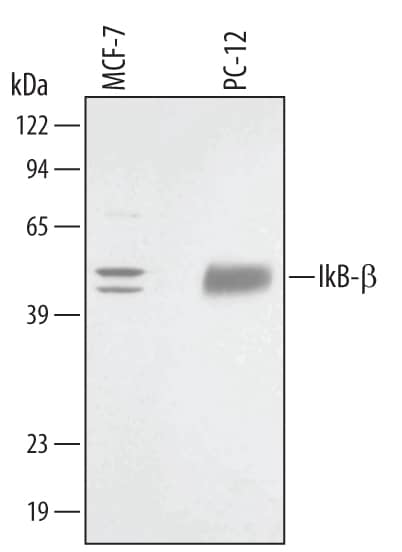 Western Blot IkB-beta Antibody (347428)