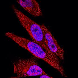 IkB-a was detected in immersion fixed HeLa human cervical epithelial carcinoma cell line using Sheep Anti-Human/Mouse IkB-a Antigen Affinity-purified Polyclonal Antibody (Catalog # AF4299) at 5 µg/mL for 3 hours at room temperature. Cells were stained using the NorthernLights™ 557-conjugated Anti-Sheep IgG Secondary Antibody (red; NL010) and counterstained with DAPI (blue). Specific staining was localized to cytoplasm and nuclei. View our protocol for Fluorescent ICC Staining of Cells on Coverslips.