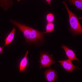IkB-a was detected in immersion fixed HeLa human cervical epithelial carcinoma cell line using Sheep Anti-Human/Mouse IkB-a Antigen Affinity-purified Polyclonal Antibody (Catalog # AF4299) at 5 µg/mL for 3 hours at room temperature. Cells were stained using the NorthernLights™ 557-conjugated Anti-Sheep IgG Secondary Antibody (red; NL010) and counterstained with DAPI (blue). View our protocol for Fluorescent ICC Staining of Cells on Coverslips.
