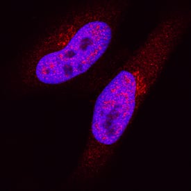 Immunocytochemistry Importin alpha 2/KPNA2 Antibody (682239) [Unconjugated]