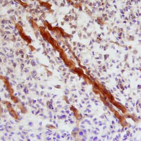 Immunohistochemistry Indian Hedgehog/Ihh Antibody - N-Terminus