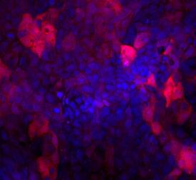 Immunocytochemistry Indoleamine 2,3-dioxygenase/IDO Antibody (700838) [Unconjugated]