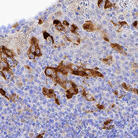 Indoleamine 2,3-dioxygenase/IDO was detected in immersion fixed paraffin-embedded sections of human tonsil using Mouse Anti-Human Indoleamine 2,3-dioxygenase/IDO Monoclonal Antibody (Catalog # MAB60301) at 1.7 µg/mL for 1 hour at room temperature followed by incubation with the Anti-Rabbit IgG VisUCyte™ HRP Polymer Antibody (Catalog # VC003). Before incubation with the primary antibody, tissue was subjected to heat-induced epitope retrieval using Antigen Retrieval Reagent-Basic (Catalog # CTS013). Tissue was stained using DAB (brown) and counterstained with hematoxylin (blue). Specific staining was localized to lymphocytes. View our protocol for IHC Staining with VisUCyte HRP Polymer Detection Reagents.