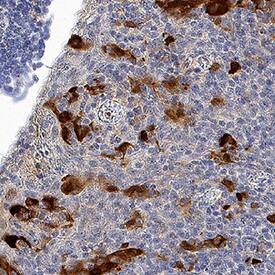 Indoleamine 2,3-dioxygenase/IDO was detected in immersion fixed paraffin-embedded sections of human tonsil tissue using Mouse Anti-Human Indoleamine 2,3-dioxygenase/IDO Monoclonal Antibody (Catalog # MAB60302) at 5 µg/mL for 1 hour at room temperature followed by incubation with the Anti-Mouse IgG VisUCyte™ HRP Polymer Antibody (Catalog # VC001). Before incubation with the primary antibody, tissue was subjected to heat-induced epitope retrieval using Antigen Retrieval Reagent-Basic (Catalog # CTS013). Tissue was stained using DAB (brown) and counterstained with hematoxylin (blue). Specific staining was localized to cytoplasm. View our protocol for IHC Staining with VisUCyte HRP Polymer Detection Reagents.