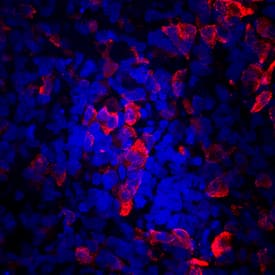 C-Peptide was detected in immersion fixed BG01V human embryonic stem cells differentiated into pancreatic beta cells using Mouse Anti-Human C-Peptide Monoclonal Antibody (Catalog # MAB14171) at 10 µg/mL for 3 hours at room temperature. Cells were stained using the NorthernLights™ 557-conjugated Anti-Mouse IgG Secondary Antibody (red; Catalog # NL007) and counterstained with DAPI (blue). Specific staining was localized to cytoplasm. View our protocol for Fluorescent ICC Staining of Stem Cells on Coverslips.
