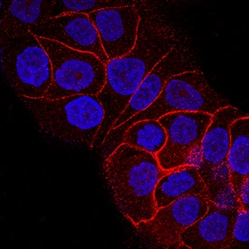 Immunocytochemistry Insulin R/CD220 Antibody (243522) [Unconjugated]