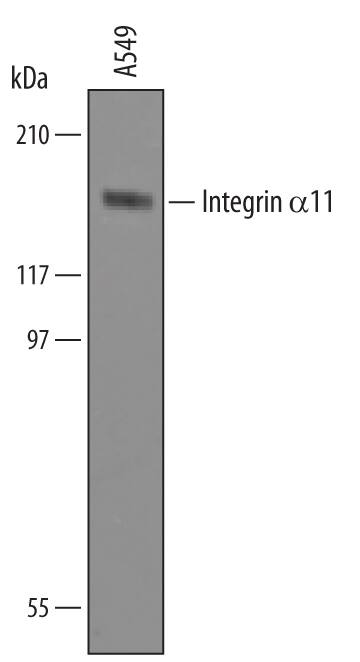 Western blot shows lysates of A549 human lung carcinoma cell line. PVDF Membrane was probed with 1 µg/mL of Goat Anti-Human Integrin a11 Antigen Affinity-purified Polyclonal Antibody (Catalog # AF4235) followed by HRP-conjugated Anti-Goat IgG Secondary Antibody (Catalog # HAF017). A specific band was detected for Integrin a11 at approximately 155 kDa (as indicated). This experiment was conducted under reducing conditions and using Immunoblot Buffer Group 8.