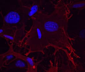 Integrin alpha 11 was detected in immersion fixed irradiated mouse embryonic fibroblasts (iMEF) using Mouse Integrin alpha 11 Affinity-purified Polyclonal Antibody (Catalog # AF6498) at 1 µg/mL for 3 hours at room temperature. Cells were stained using the NorthernLights™ 557-conjugated Anti-Sheep IgG Secondary Antibody (red; Catalog # NL010) and counterstained with DAPI (blue). Specific staining was localized to cell surfaces. View our protocol for Fluorescent ICC Staining of Cells on Coverslips.