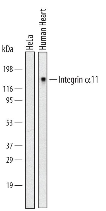 Western Blot Integrin alpha 11 Antibody (396214) [Unconjugated]