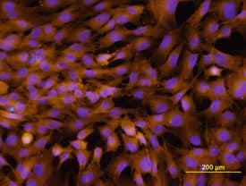 Integrin a2/ CD49b was detected in immersion fixed MG-63 human osteosarcoma cell line using Rat Anti-Human Integrin a2/ CD49b Monoclonal Anti-body (Catalog # MAB12332) at 10 µg/mL for 3 hours at room temperature. Cells were stained using the NorthernLights™ 557-conjugated Anti-Rat IgG Secondary Antibody (yellow; Catalog # NL013) and counter-stained with DAPI (blue). View our protocol for Fluorescent ICC Staining of Cells on Coverslips.