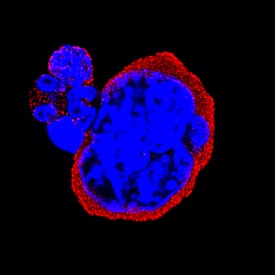 Integrin a2b/CD41 was detected in immersion fixed mouse bone marrow cells using Rat Anti-Mouse Integrin a2b/CD41 Monoclonal Antibody (Catalog # MAB41181) at 25 µg/mL for 3 hours at room temperature. Cells were stained using the NorthernLights™ 557-conjugated Anti-Rat IgG Secondary Antibody (red; Catalog # NL014) and counterstained with DAPI (blue). Specific staining was localized to cell surfaces and cytoplasm. View our protocol for Fluorescent ICC Staining of Non-adherent Cells.