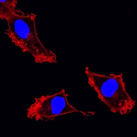Integrin a3/CD49c was detected in immersion fixed HT1080 human fibrosarcoma cell line using Mouse Anti-Human Integrin a3/CD49c Monoclonal Antibody (Catalog # MAB1345) at 25 µg/mL for 3 hours at room temperature. Cells were stained using the NorthernLights™ 557-conjugated Anti-Mouse IgG Secondary Antibody (red; Catalog # NL007) and counterstained with DAPI (blue). Specific staining was localized to plasma membranes and cytoplasm. View our protocol for Fluorescent ICC Staining of Cells on Coverslips.