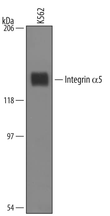 Western Blot Integrin alpha 5/CD49e Antibody [Unconjugated]
