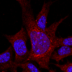 Immunocytochemistry Integrin alpha 8 Antibody [Unconjugated]