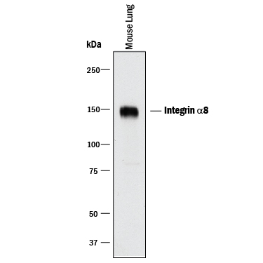 Western Blot Integrin alpha 8 Antibody [Unconjugated]