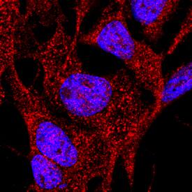 Integrin a8 was detected in immersion fixed 4T1 mouse breast cancer cell line using Goat Anti-Mouse Integrin a8 Biotinylated Antigen Affinity-purified Polyclonal Antibody (Catalog # BAF4076) at 10 µg/mL for 3 hours at room temperature. Cells were stained using the NorthernLights™ 557-conjugated Streptavidin (red; NL999) and counterstained with DAPI(blue). Specific staining was localized to cytoplasm and cell surface. View our protocol for Fluorescent ICC Staining of Cells on Coverslips.