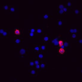 CD11b/Integrin aM was detected in immersion fixed mouse splenocytes using Rat Anti-Mouse CD11b/Integrin aM Biotinylated Monoclonal Antibody (Catalog # BAM1124) at 10 µg/mL for 3 hours at room temperature. Cells were stained using the Northern-Lights™ 557-conjugated Streptavidin (red; Catalog # NL999) and counterstained with DAPI (blue). View our protocol for Fluorescent ICC Staining of Non-adherent Cells.