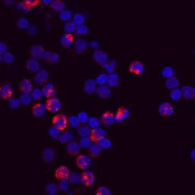 CD11b/Integrin aM was detected in immersion fixed human peripheral blood mononuclear cells (PBMCs) using Mouse Anti-Human CD11b/Integrin aM Monoclonal Antibody (Catalog # MAB1699) at 10 µg/mL for 3 hours at room temperature. Cells were stained using the NorthernLights™ 557-conjugated Anti-Mouse IgG Secondary Antibody (red; Catalog # NL007) and counterstained with DAPI (blue). View our protocol for Fluorescent ICC Staining of Non-adherent Cells.