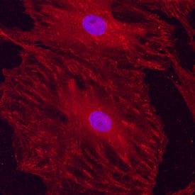 Integrin aV/CD51 was detected in immersion fixed undifferentiated rat mesenchymal stem cells using Goat Anti-Human/Mouse/Rat Integrin aV/CD51 Antigen Affinity-purified Polyclonal Antibody (Catalog # AF1219) at 10 µg/mL for 3 hours at room temperature. Cells were stained using the NorthernLights™ 557-conjugated Anti-Goat IgG Secondary Antibody (red; Catalog # NL001) and counterstained with DAPI (blue). Specific staining was localized to cytoplasm. View our protocol for Fluorescent ICC Staining of Cells on Coverslips.