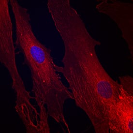 Integrin  beta 1/CD29 was detected in immersion fixed human mesenchymal stem cells using Goat Anti-Human/Canine Integrin  beta 1/CD29 Antigen Affinity-purified Polyclonal Antibody (Catalog # AF1778) at 10 µg/mL for 3 hours at room temperature. Cells were stained using the NorthernLights™ 557-conjugated Anti-Goat IgG Secondary Antibody (red; Catalog # NL001) and counterstained with DAPI (blue). Specific staining was localized to cell surfaces. View our protocol for Fluorescent ICC Staining of Stem Cells on Coverslips.