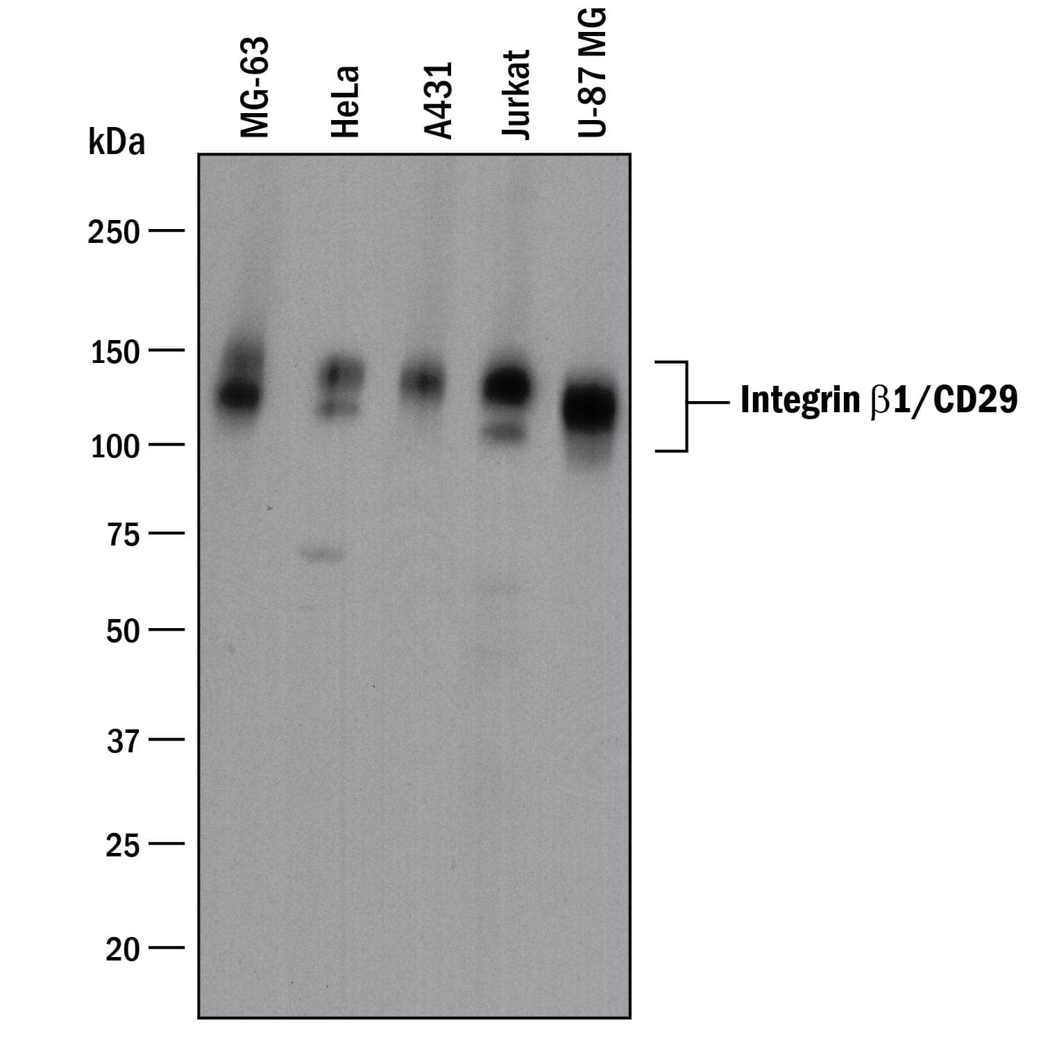 Western blot shows lysates of MG-63 human osteosarcoma cell line, HeLa human cervical epithelial carcinoma cell line, A431 human epithelial carcinoma cell line, Jurkat human acute T cell leukemia cell line, and U-87 MG human glioblastoma/astrocytoma cell line. PVDF membrane was probed with 1 µg/mL of Goat Anti-Human/Canine Integrin  beta 1/CD29 Antigen Affinity-purified Polyclonal Antibody (Catalog # AF1778) followed by HRP-conjugated Anti-Goat IgG Secondary Antibody (Catalog # HAF017). Specific bands were detected for Integrin  beta 1/CD29 at approximately 130-140 kDa (as indicated). This experiment was conducted under reducing conditions and using Immunoblot Buffer Group 1.