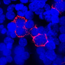 Immunocytochemistry Integrin beta 1/CD29 Antibody (P5D2) [Unconjugated]