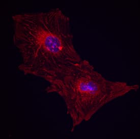 Integrin  beta 1/CD29 was detected in immersion fixed porcine mesenchymal stem cells using Mouse Anti-Human/Porcine/Equine Integrin  beta 1/CD29 Monoclonal Antibody (Catalog # MAB17783) at 10 µg/mL for 3 hours at room temperature. Cells were stained using the NorthernLights™ 557-conjugated Anti-Mouse IgG Secondary Antibody (red; NL007) and counterstained with DAPI (blue). Specific staining was localized to cell surfaces. View our protocol for Fluorescent ICC Staining of Stem Cells on Coverslips.
