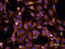 Integrin  beta 1/CD29 was detected in immersion fixed MG-63 human osteosarcoma cell line using Mouse Anti-Human Integrin  beta 1/CD29 Monoclonal Anti-body (Catalog # MAB1778) at 10 µg/mL for 3 hours at room temperature. Cells were stained using the NorthernLights™ 557-conjugated Anti-Mouse IgG Secondary Anti-body (yellow; NL007) and counter-stained with DAPI (blue). View our protocol for Fluorescent ICC Staining of Cells on Coverslips.