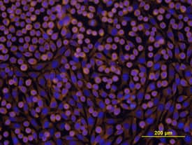 Integrin  beta 1/CD29 was detected in immersion fixed L-929 mouse fibroblast cell line using Rat Anti-Mouse Integrin  beta 1/CD29 Monoclonal Antibody (Catalog # MAB2405) at 10 µg/mL for 3 hours at room temperature. Cells were stained using the NorthernLights™ 557-conjugated Anti-Rat IgG Secondary Antibody (yellow; Catalog # NL013) and counterstained with DAPI (blue). View our protocol for Fluorescent ICC Staining of Cells on Coverslips.