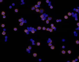Immunocytochemistry Integrin beta 2/CD18 Antibody (212701) [Unconjugated]