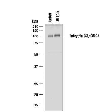Western blot shows lysates of Jurkat human acute T cell leukemia cell line and DU145 human prostate carcinoma cell line. PVDF membrane was probed with 1 µg/mL of Goat Anti-Human Integrin  beta 3/ CD61 Antigen Affinity-purified Polyclonal Antibody (Catalog # AF2266) followed by HRP-conjugated Anti-Goat IgG Secondary Antibody (HAF017). A specific band was detected for Integrin  beta 3/CD61 at approximately 100 kDa (as indicated). This experiment was conducted under reducing conditions and using Immunoblot Buffer Group 1.