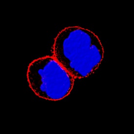 Integrin  beta 4/CD104 was detected in immersion fixed A431 human epithelial carcinoma cell line using Sheep Anti-Human Integrin  beta 4/CD104 Antigen Affinity-purified Polyclonal Antibody (Catalog # AF4060) at 15 &micro;g/mL for 3 hours at room temperature. Cells were stained using the NorthernLights&trade; 557-conjugated Anti-Sheep IgG Secondary Antibody (red; Catalog # NL010) and counterstained with DAPI (blue). Specific staining was localized to cell surfaces. View our protocol for Fluorescent ICC Staining of Cells on Coverslips.