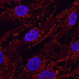 Immunocytochemistry Integrin beta 5 Antibody [Unconjugated]