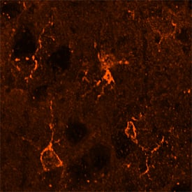 Integrin  beta 5 was detected in perfusion fixed frozen sections of mouse brain using Sheep Anti-Mouse/Rat Integrin  beta 5 Antigen Affinity-purified Polyclonal Antibody (Catalog # AF8035) at 15 µg/mL overnight at 4 °C. Tissue was stained using the Northern-Lights™ 557-conjugated Anti-Sheep IgG Secondary Antibody (red; Catalog # NL010). Specific staining was localized to glial cells. View our protocol for Fluorescent IHC Staining of Frozen Tissue Sections.